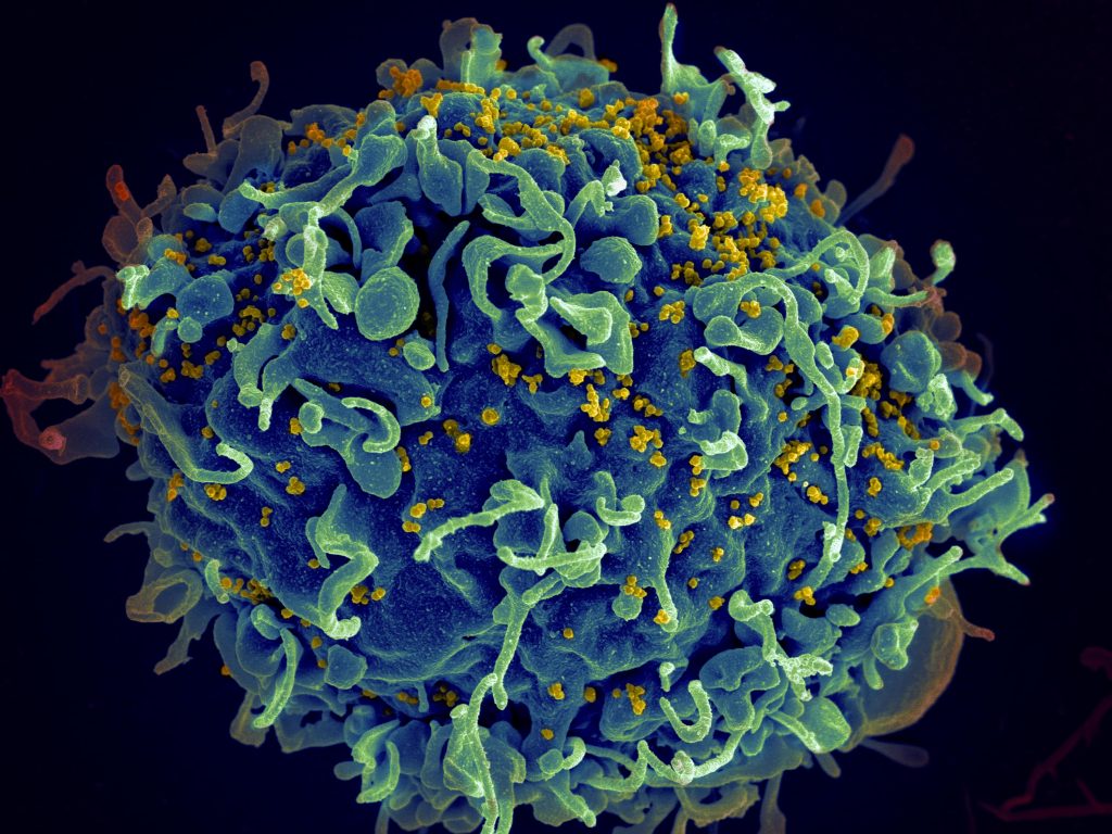 Image of a T cell (blue) under attack from HIV (yellow). Pic: National Institute of Health